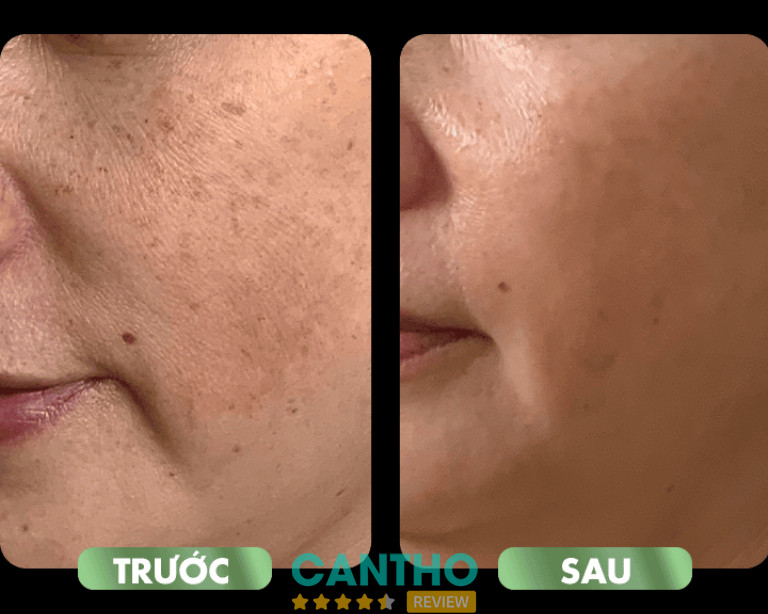 Trung Tâm Thẩm Mỹ Y Khoa Meraki tại Cần Thơ 