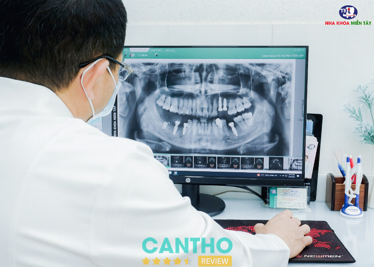 tiêu chuẩn khám tại Phòng khám Nha Khoa Miền Tây 