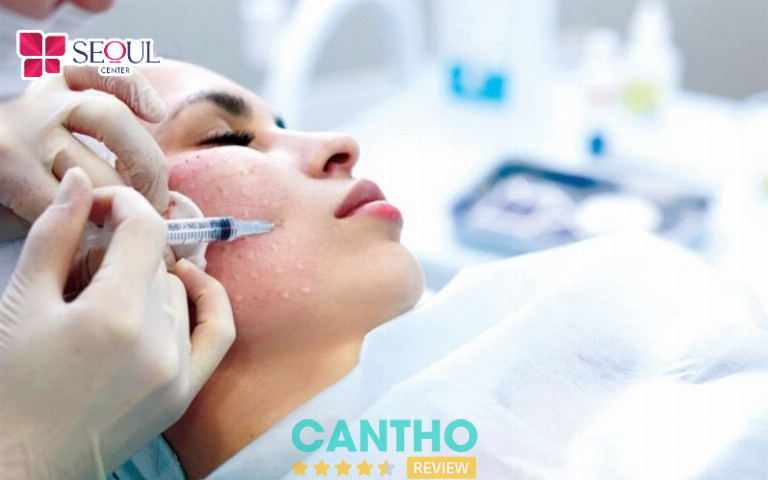 Thẩm Mỹ Viện Seoul Center tiêm filler tại Cần Thơ 