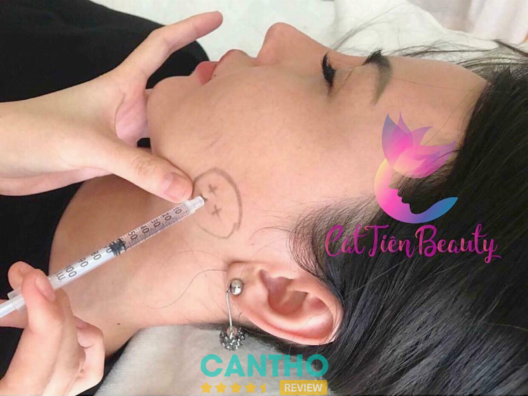 Viện Thẩm Mỹ Cát Tiên By Trâm Nguyễn chuyên tiêm filler ở Cần Thơ