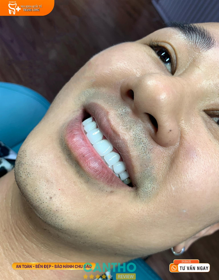 Nha khoa Quốc tế Thăng Long ở Sóc Trăng