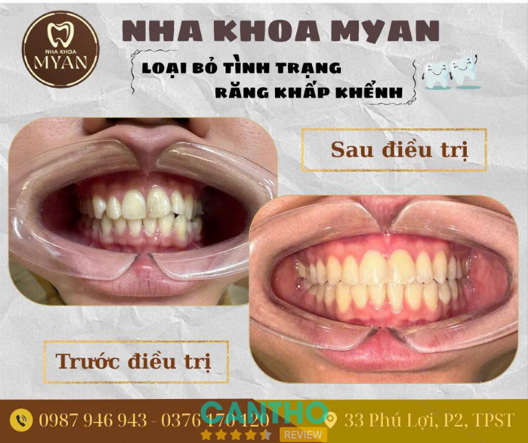 Phòng khám nha khoa ở Sóc Trăng  - MYAN