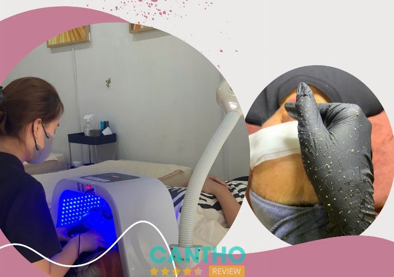 Ánh Dương Beauty 3 là Spa chăm sóc da ở Ngã Bảy