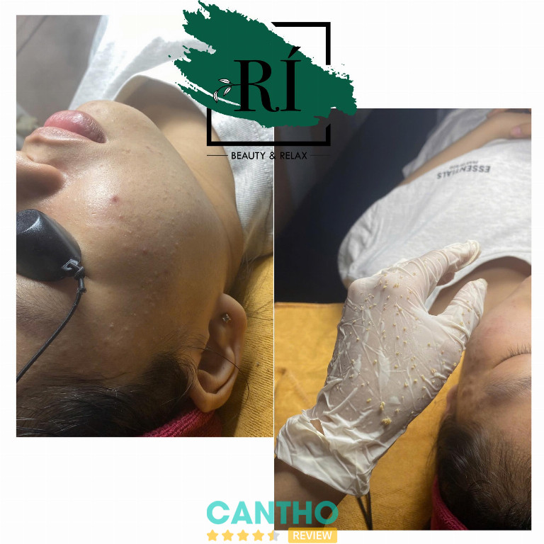 Rí Spa trị mụn ở Ngã Bảy