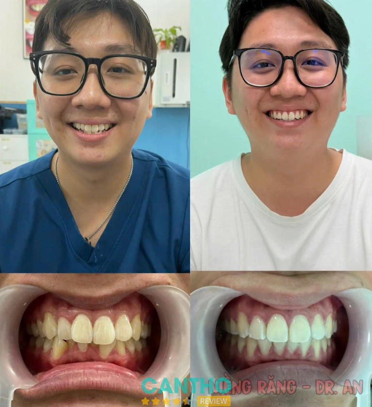 Nha Khoa An Khang niềng răng Ngã Bảy