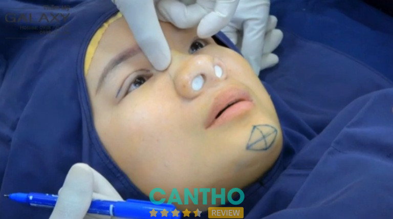 Địa chỉ cắt mí đẹp ở Cần Thơ