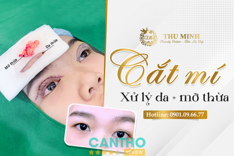 Thẩm Mỹ Thu Minh cắt mí mắt uy tín tại Cần Thơ