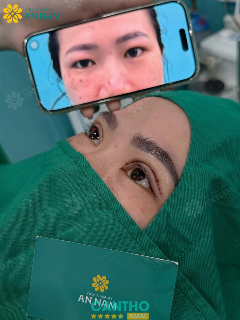 Phòng khám Chuyên khoa Thẩm mỹ An Nam cắt mí ở Cần Thơ