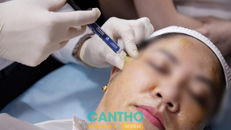 Địa chỉ tiêm Filler uy tín ở Sóc Trăng