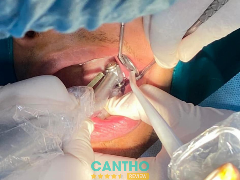 địa chỉ trồng răng implant ở Ngã Bảy