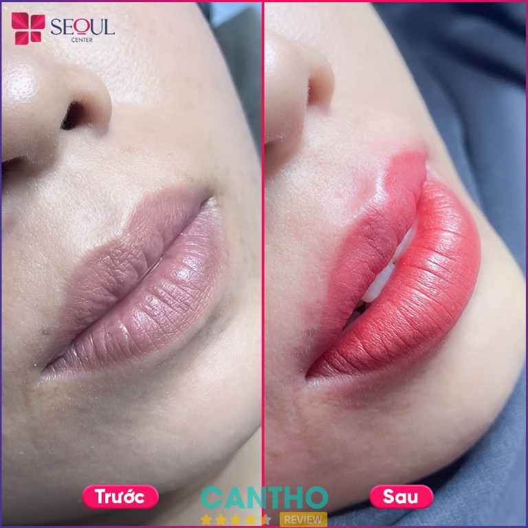 Thẩm Mỹ Viện Seoul Center phun xăm thẩm mỹ môi, mày đẹp ở Ngã Bảy