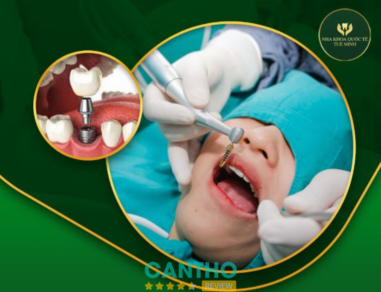 Nha Khoa Quốc Tế Tuệ Minh