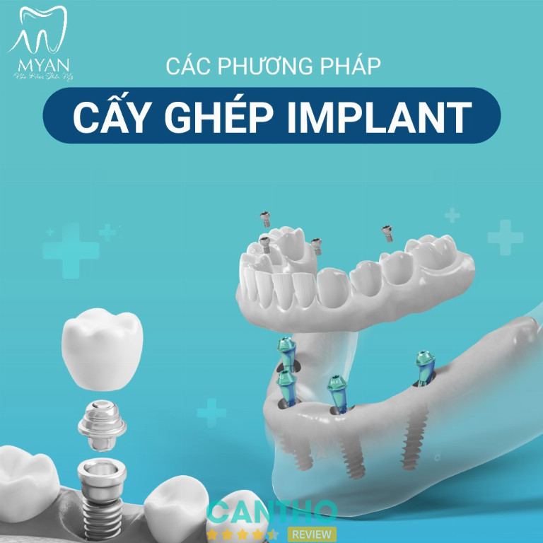 Nha khoa Thẩm mỹ MYAN