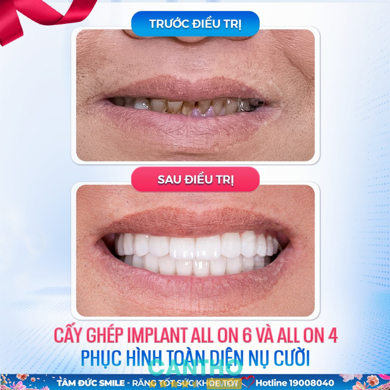 Nha Khoa Tâm Đức Smile