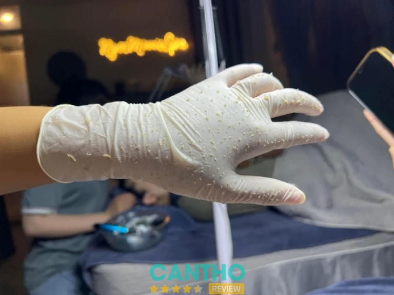 Ngọc Minnie Spa - Cần Thơ – hình ảnh chăm sóc da