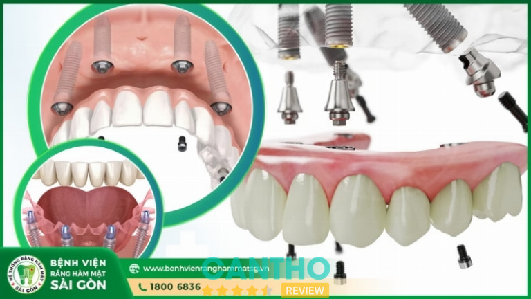 Bệnh Viện Răng Hàm Mặt Sài Gòn