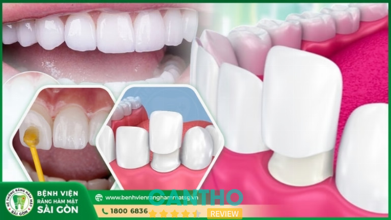 Bệnh Viện Răng Hàm Mặt Sài Gòn