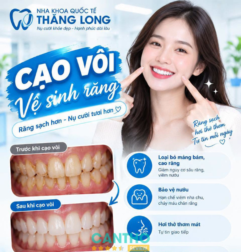 Nha Khoa Quốc Tế Thăng Long - Cần Thơ