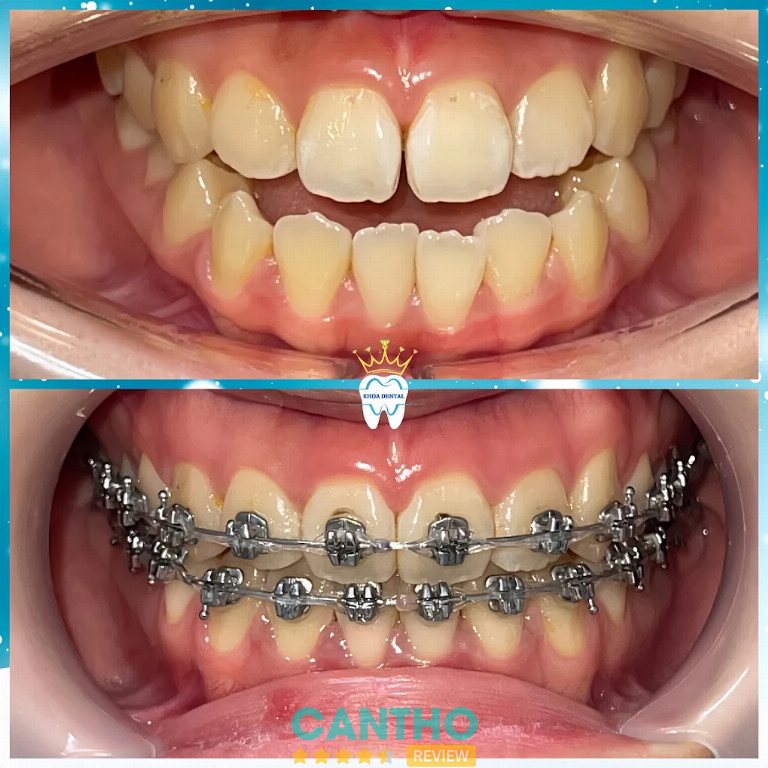 Nha Khoa Cần Thơ KHOA DENTAL tại 388J/14B Tân An