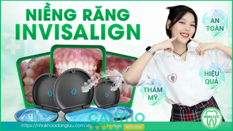 niềng răng tại Nha Khoa Đăng Lưu