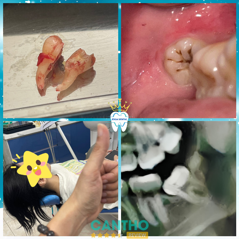 Nha Khoa Cần Thơ Khoa Dental tại Tân An